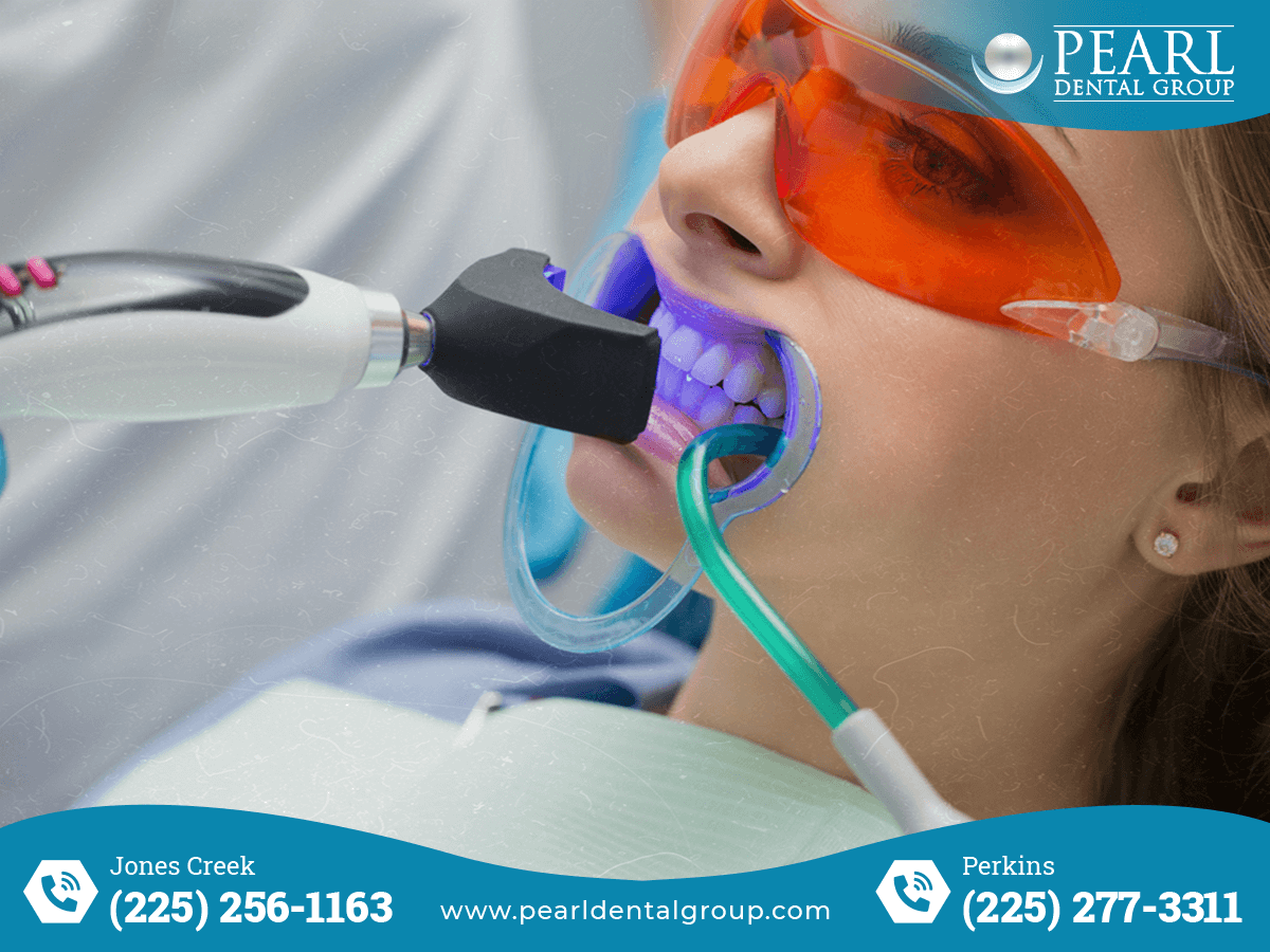 Emergency Dentist in Baton Rouge: What to Do When Dental Emergencies Strike