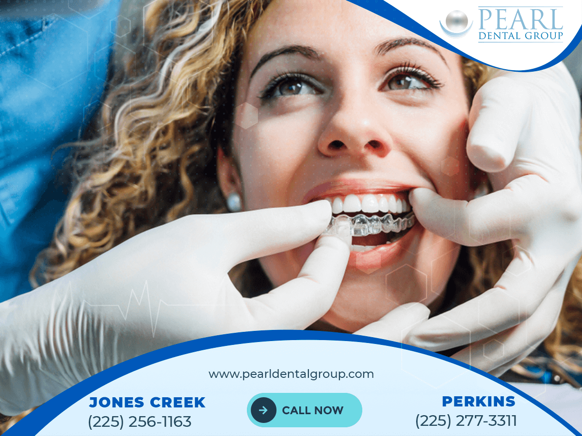 Expert Tooth Extraction Services in Baton Rouge at Pearl Dental Group