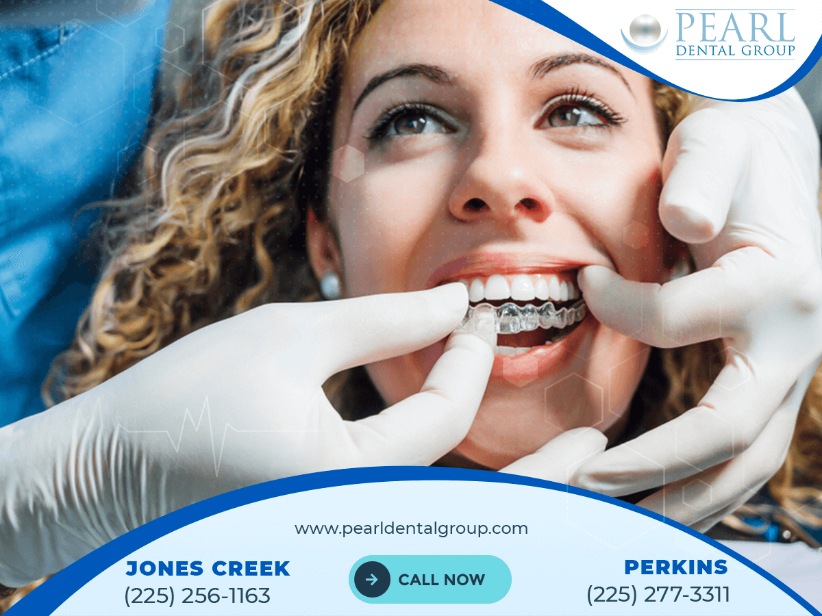 Tooth extraction Baton Rouge