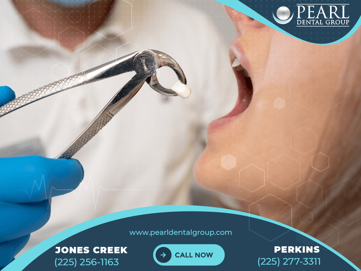 Pearl Dental Group: Your Trusted Dental Clinic in Baton Rouge