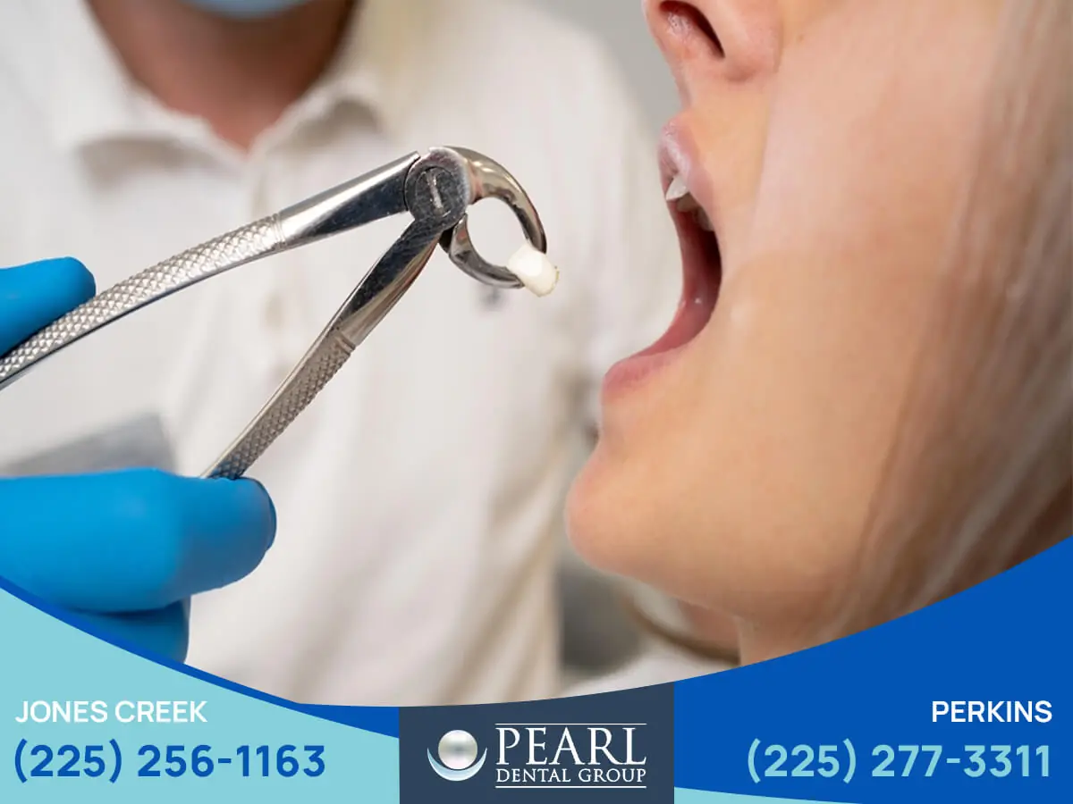 Best Emergency Dentist in Baton Rouge