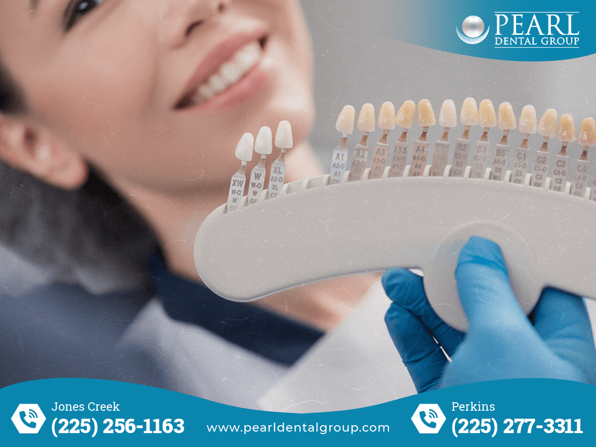 Keep a Healthy Smile with Professional Teeth Cleaning in Baton Rouge