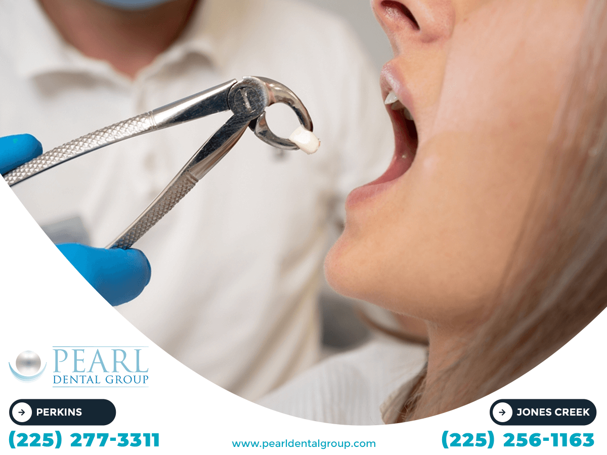 Finding an Affordable Dentist in Baton Rouge: Quality Care