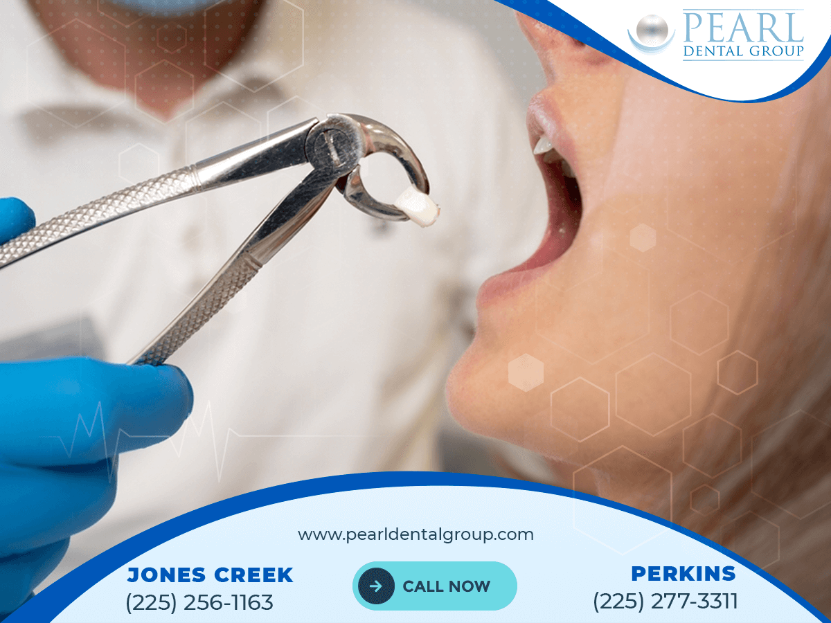 Conclusion the Best Cosmetic Dentist in Baton Rouge