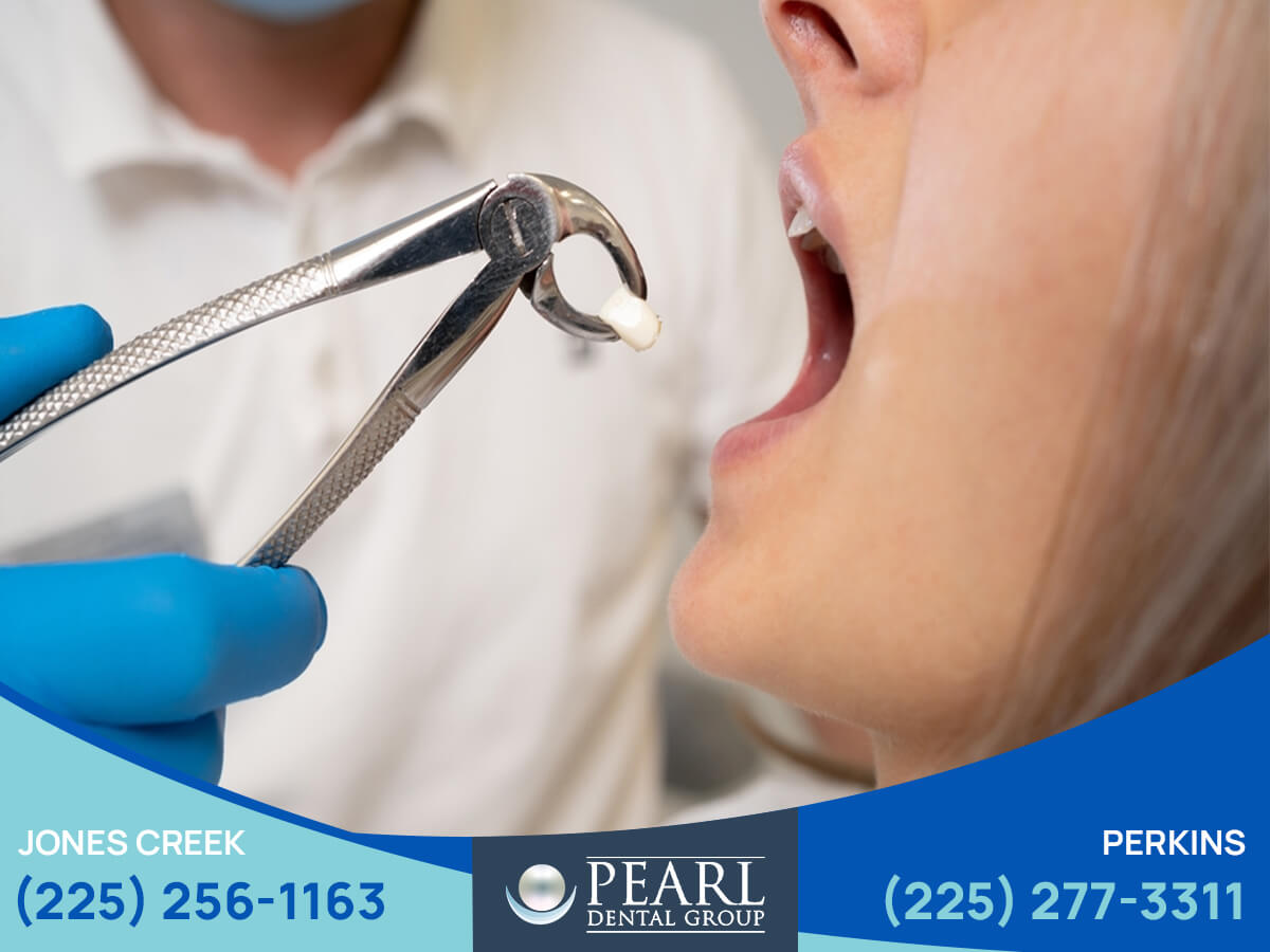Smile with Invisalign in Baton Rouge