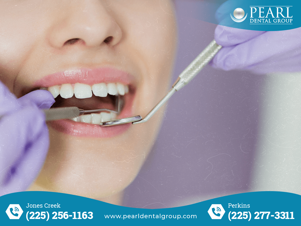 Outcome an Affordable Dentist in Baton Rouge: Excellence Care Without Compromise