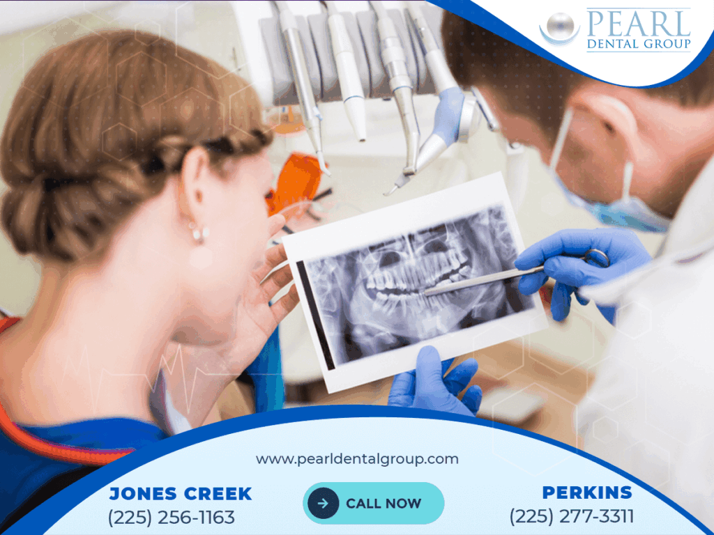 dental implant cost Baton Rouge