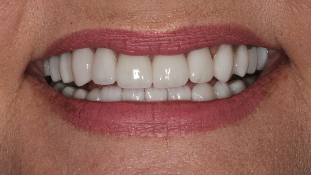 Top Cosmetic Dentist in Baton Rouge