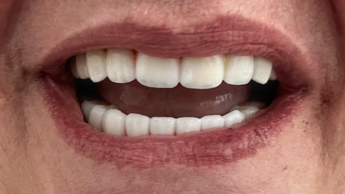 Calm, Comfortable Care: Discover the Benefits of Sedation Dentistry in Baton Rouge