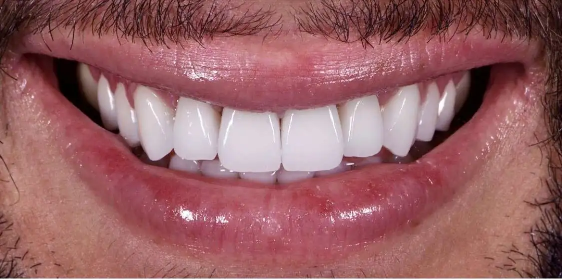 jagged2
